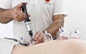 بهترین دکتر حجامت در تهران | بهترین مرکز حجامت در تهران | مطب معتبر حجامت و طب سنتی
